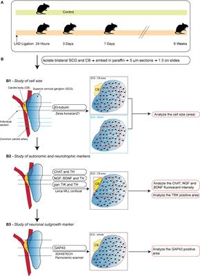 Acute myocardial infarction induces remodeling of the murine superior cervical ganglia and the carotid body